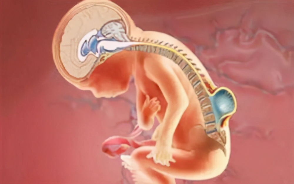 脊柱裂诊断与治疗,脊柱裂症状有哪些表现