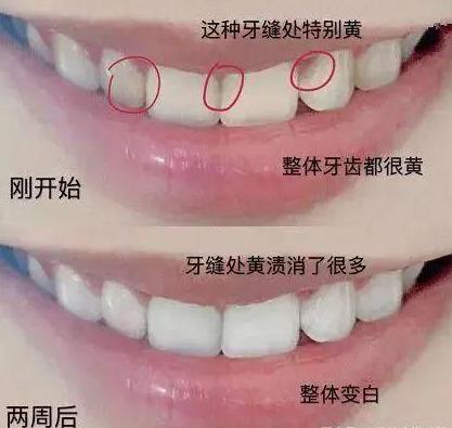 杨颖和姚晨演技,姚晨和杨颖谁的嘴巴大