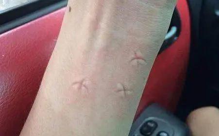 用什么土方法灭蚊子,有什么土办法灭蚊子