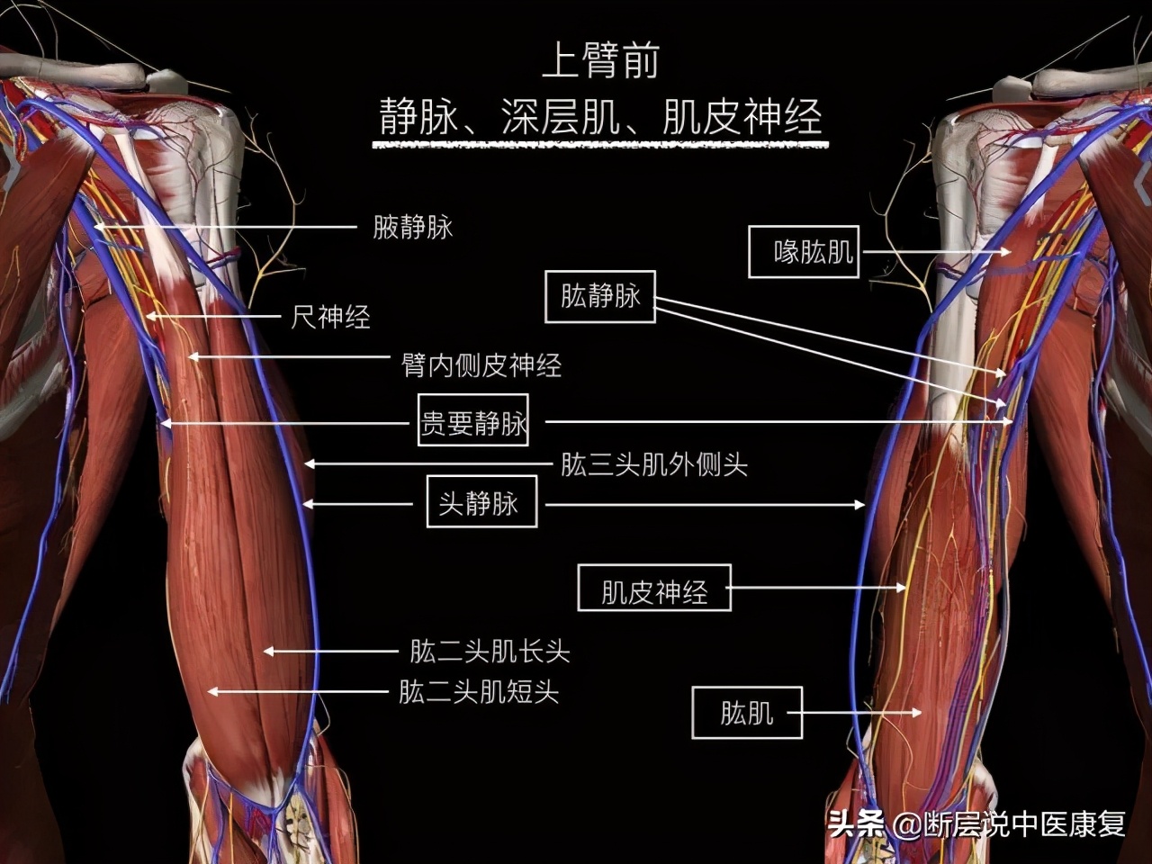 手臂人体解剖图讲解,手臂上举3d肌肉解剖讲解