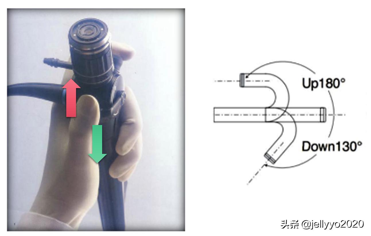 支气管镜细针操作视频及讲解,气管镜的正确手法图解