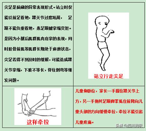 四川脑瘫康复训练有效果吗,成都脑瘫恢复中心