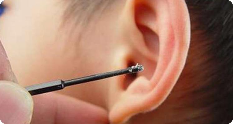 耳屎结成硬块一掏就出血,耳朵里耳屎粘在耳壁上像个瘤