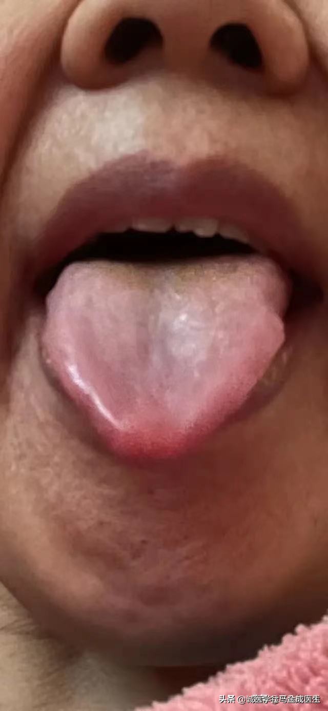 痛经月经量多中药方剂,痛经月经量少吃什么中成药