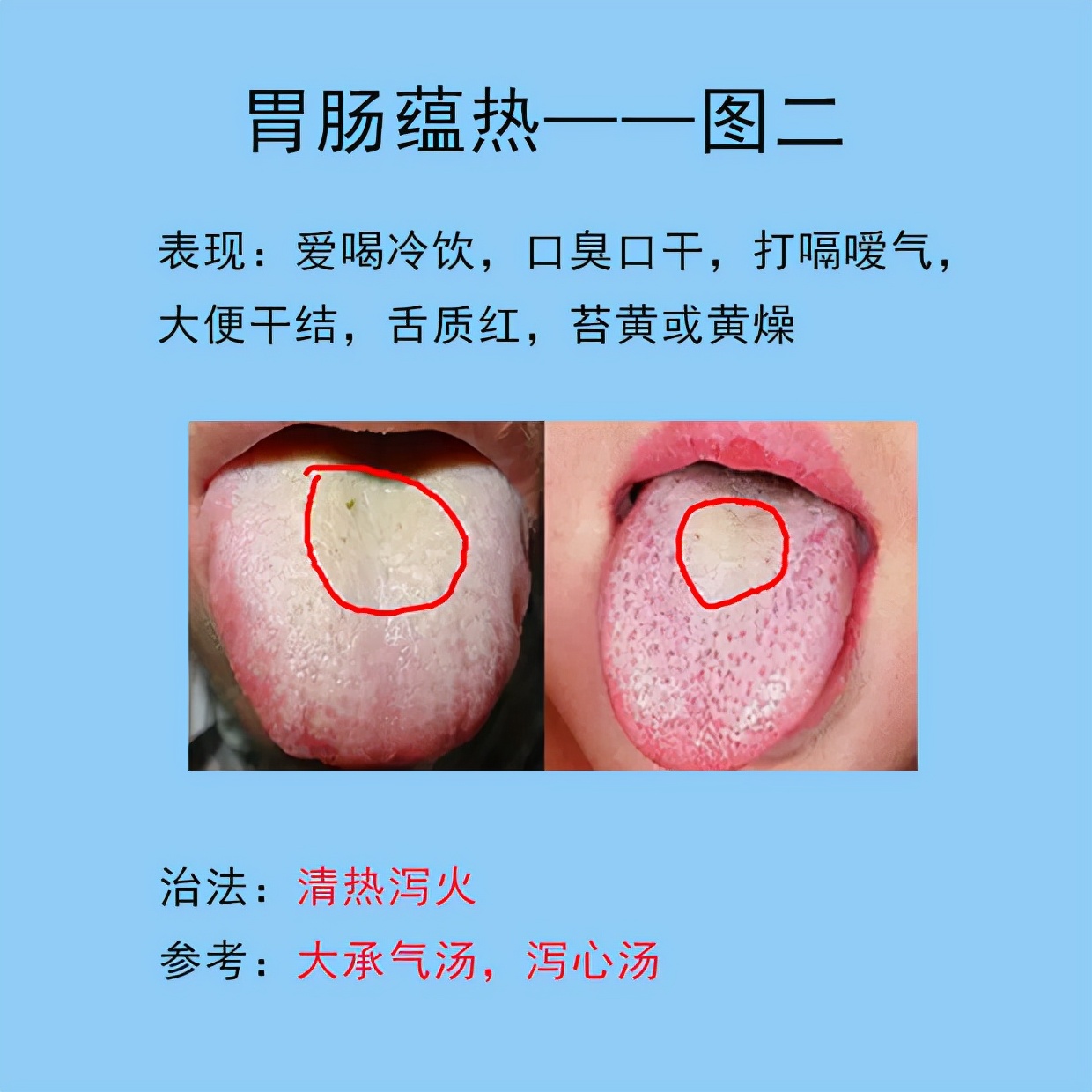 根据舌象判断用哪种调理脾胃的药,脾胃常见的症状