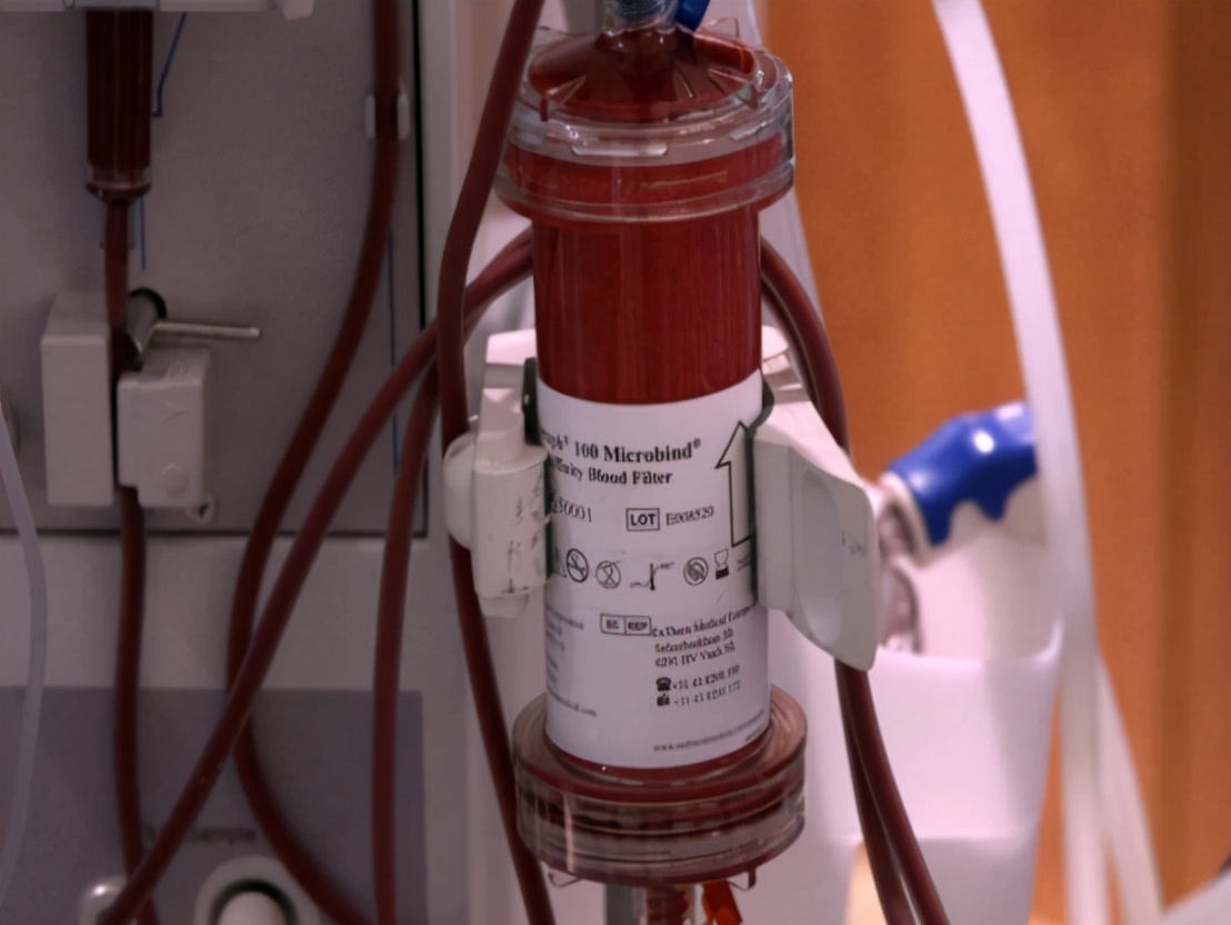 亲人不幸进了ICU,都会经历哪些痛苦?先给你介绍4个