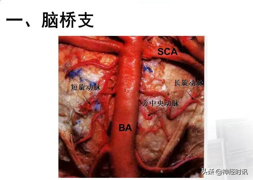 脑动脉解剖学讲解,基底节区脑血管解剖