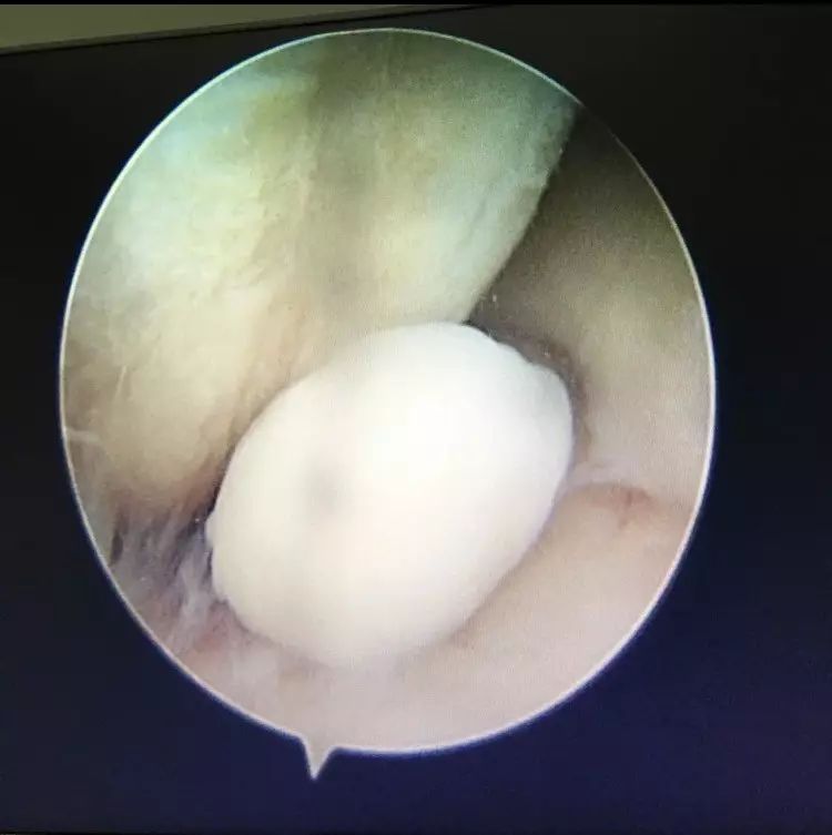 膝关节活动有响声应该看什么科室,膝关节活动有响声是怎么回事