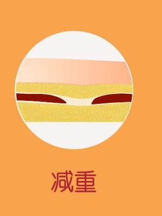 男性体脂20%是先减脂还是增肌,体脂在正常范围内要继续减脂吗