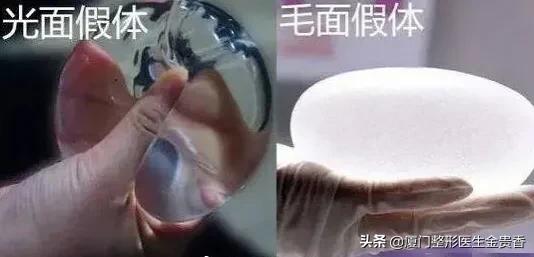 丰胸假体有哪些品牌好用,假体丰胸假体质量