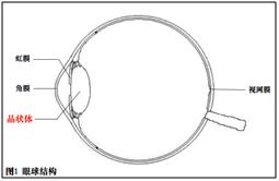 科普|“雾里看花”为哪般