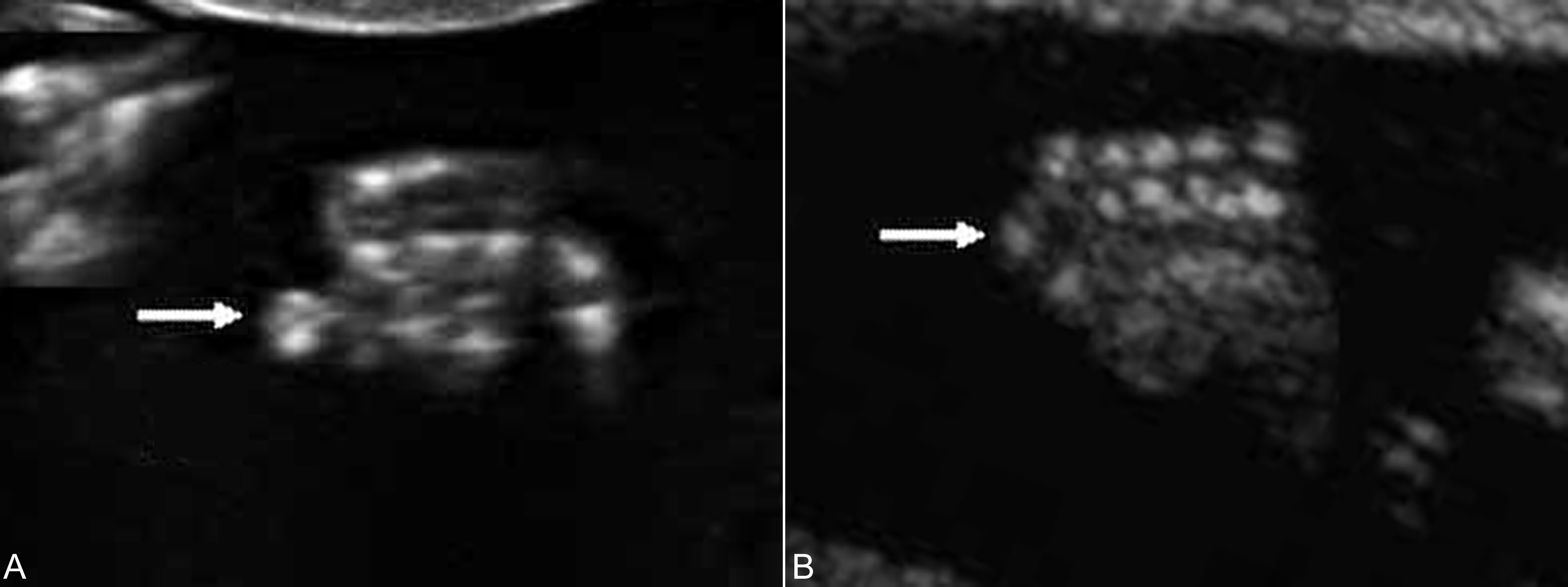 明明白白做b超,明明白白做超声