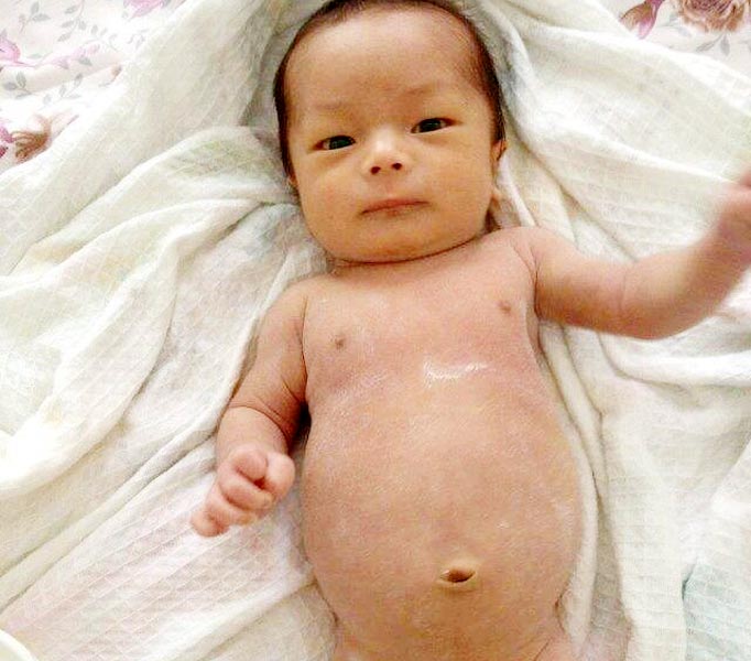 2-3个月宝宝生长发育问题,2个月宝宝生长发育缓慢怎么办