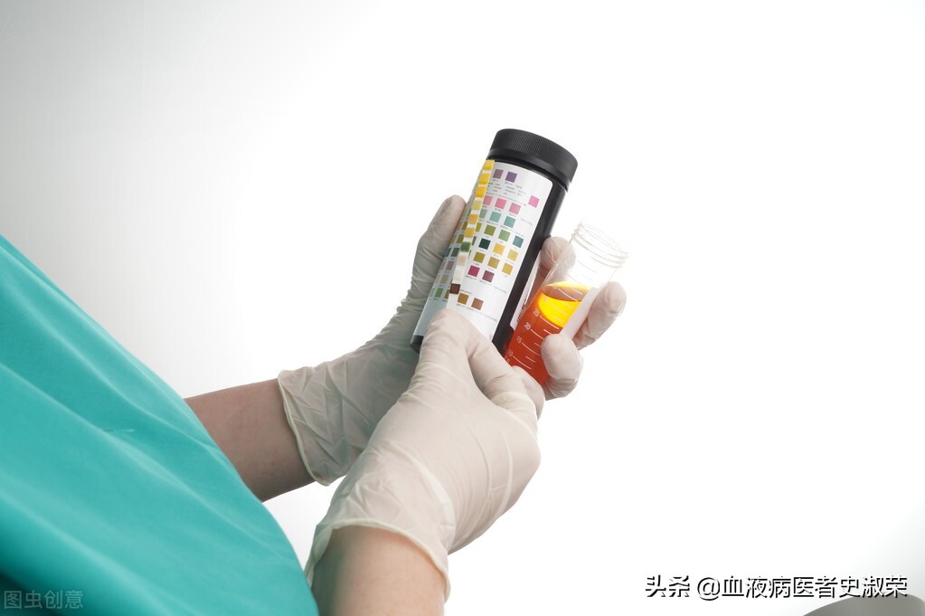 过敏性紫癜肾脏损害多久出现,过敏性紫癜反复发作会影响肾脏吗