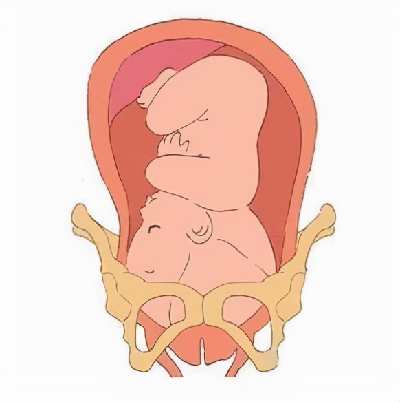 孕后期好害怕生产,孕后期担心胎儿健康