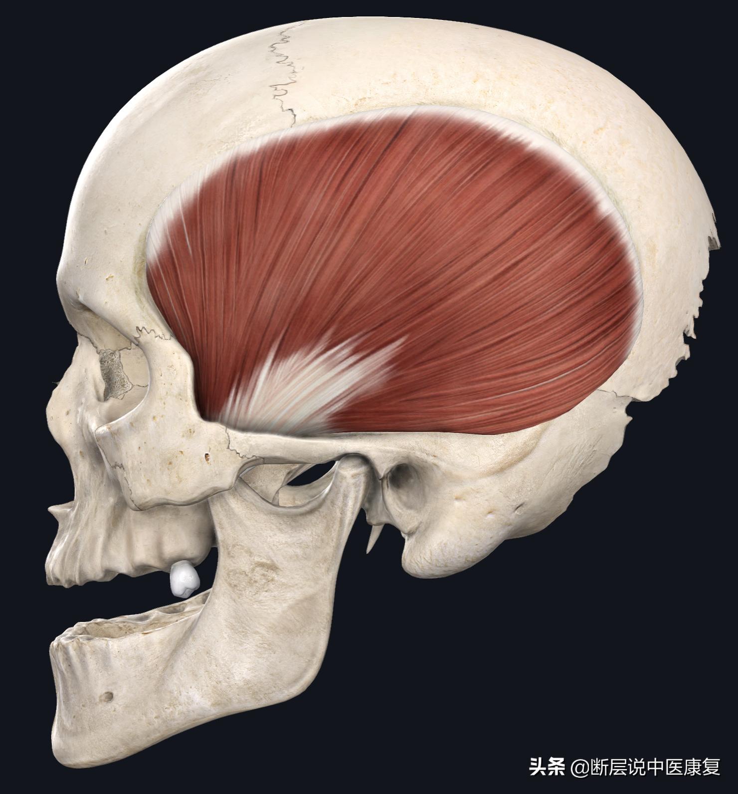 颞部头痛怎么办快速缓解,拉伸颞肌缓解偏头痛