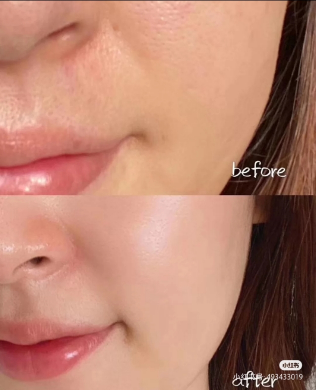 片仔癀雪肌无暇润白泥面膜好用吗,夏天到了护肤要素