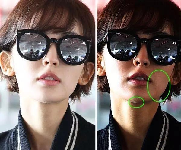 娜扎闭口怎么消除,娜扎刘诗诗原装脸