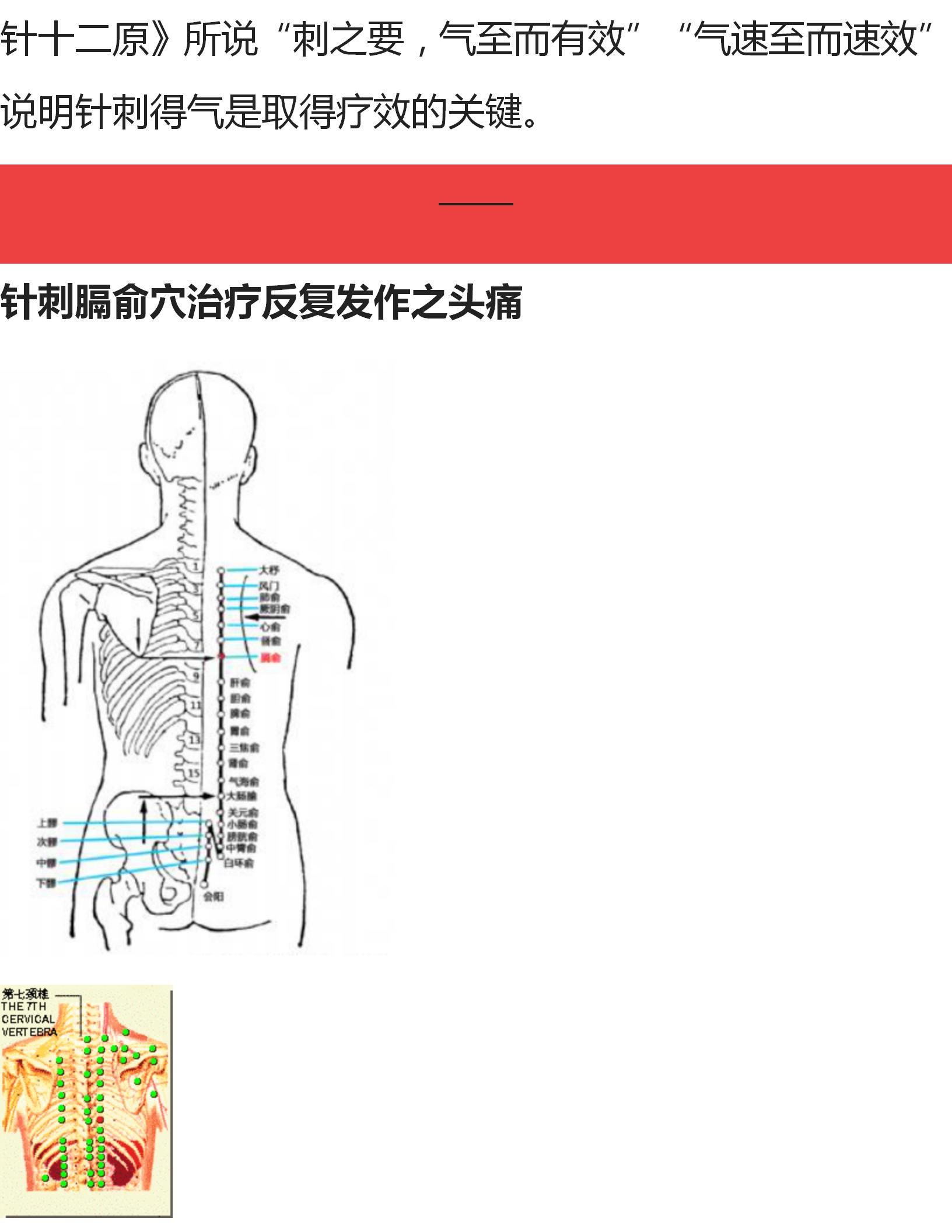 各种痛症的针灸方法,董氏奇穴大拇指腱鞘炎针灸取穴