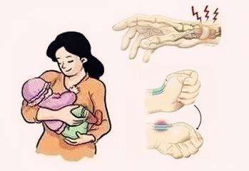 妈妈手如何恢复健康,妈妈手怎么处理