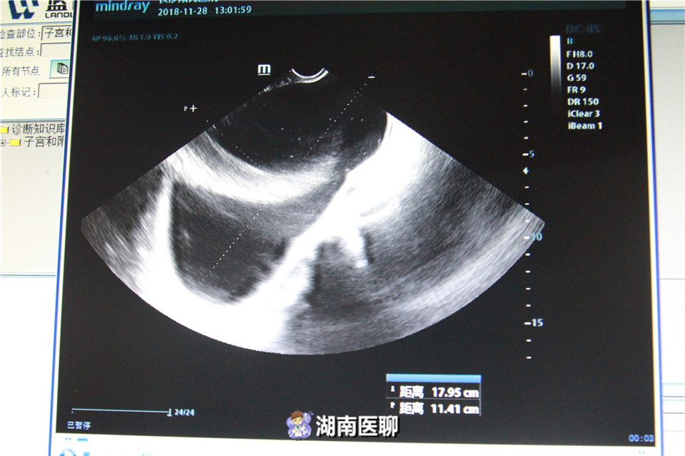 女性备孕3个月没怀上,备孕很久都没怀上的女人怎么了