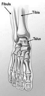 特殊骨折类型,特殊骨折体征