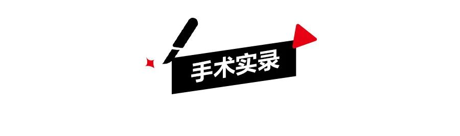 女子突然肚子疼手术,深圳女子突然肚子疼