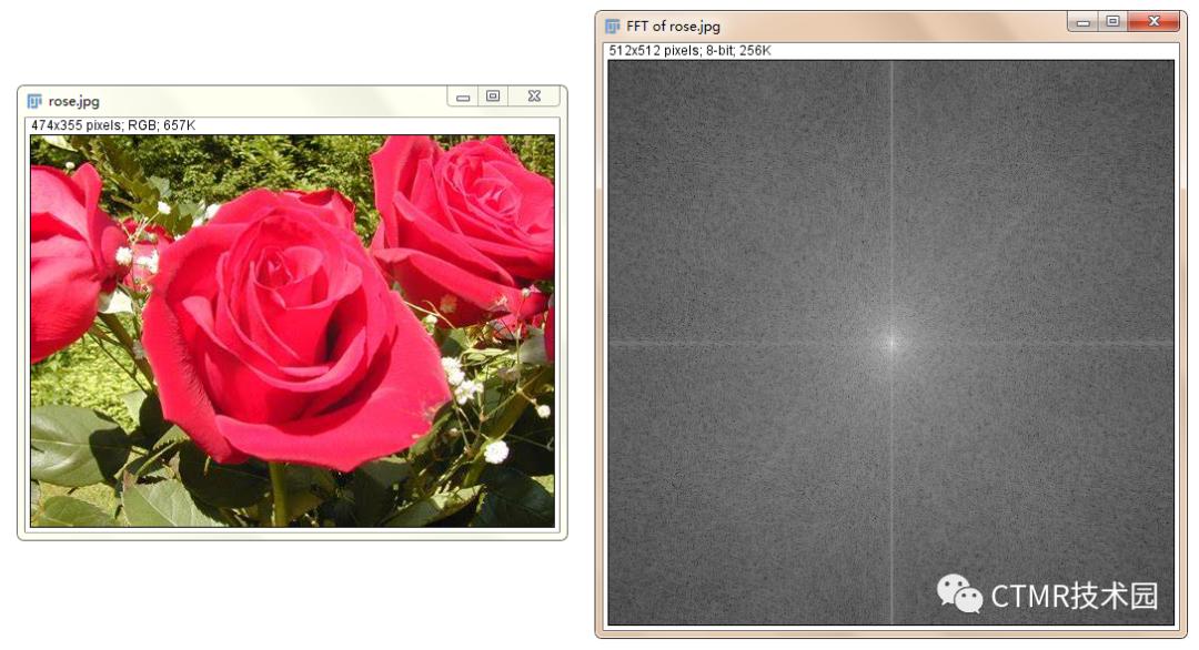 磁共振成像的基本原理和优缺点,为什么磁共振成像要很久