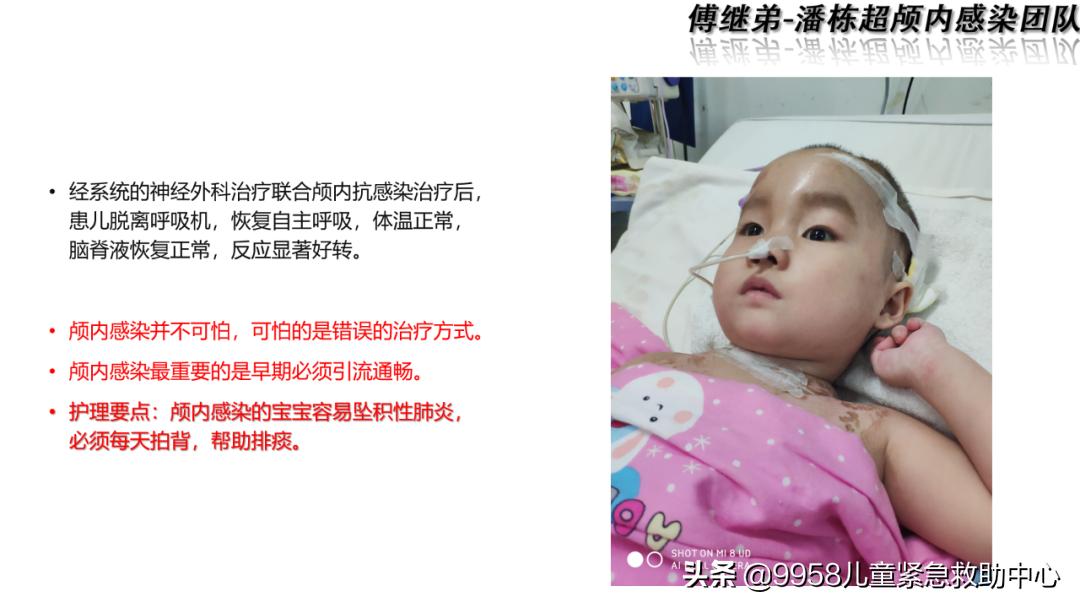 颅内感染康复治疗知识,小儿颅内感染的健康宣教