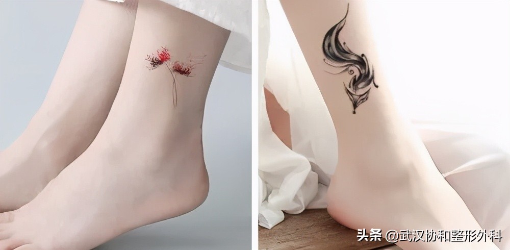 激光洗纹身出血吗,洗纹身是什么体验