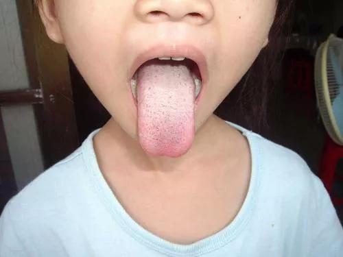 3岁孩子嘴巴臭怎么处理,3岁女孩口很臭怎么回事