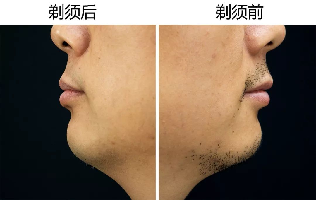 荷兰进口飞利浦剃须刀s9000价格,飞利浦S9000舒仕系列电动剃须刀