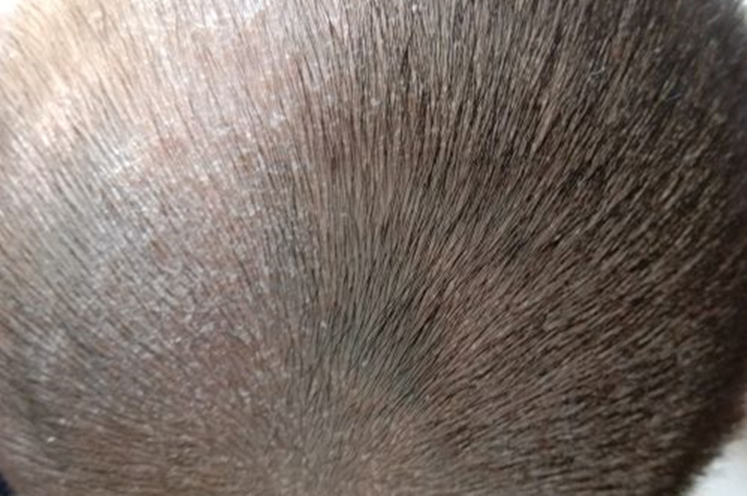 宝宝这四个部位再脏也别洗,宝宝哪些部位不宜过度清洁