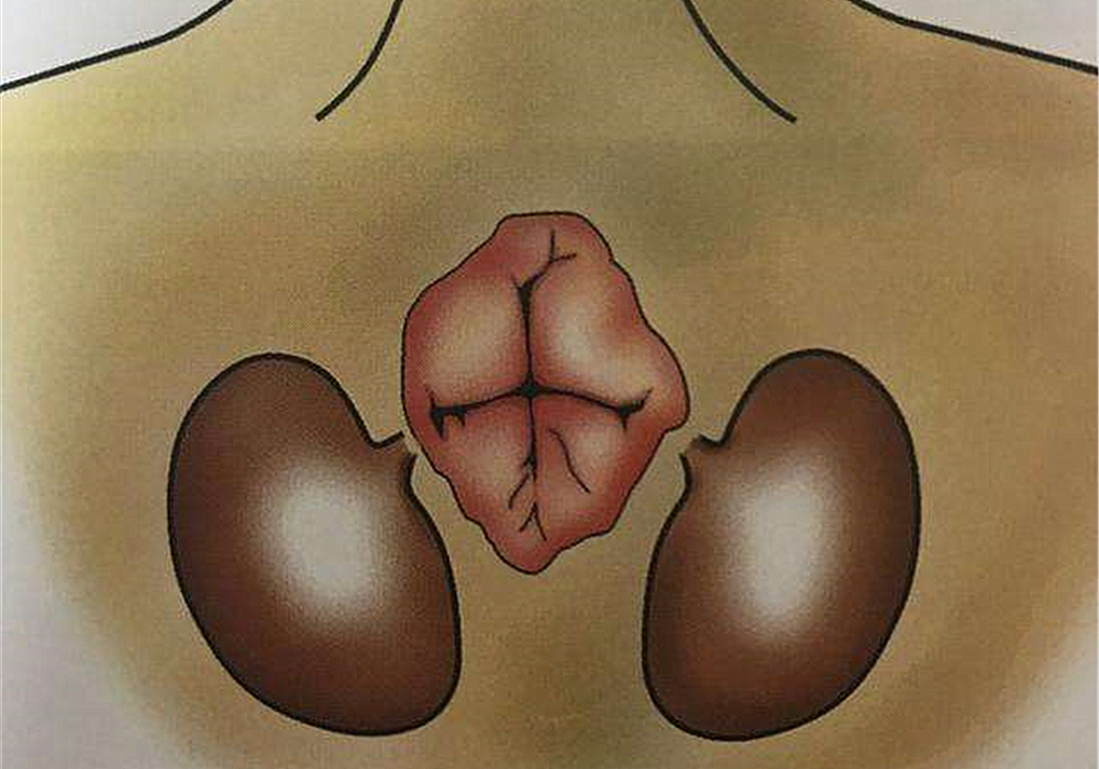 猫咪的肛门腺不一定要挤，但前提是主人做好定期检查