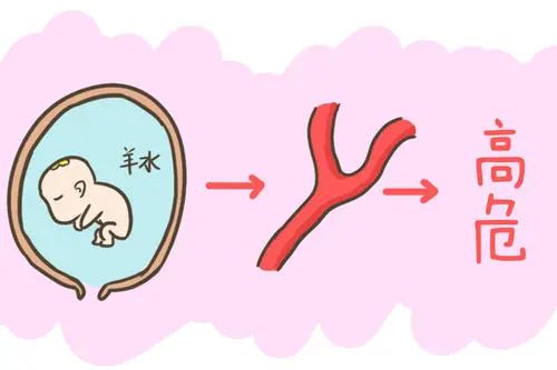 孕妇发生羊水栓塞首先该怎么处理,孕妇羊水栓塞发生在什么时候
