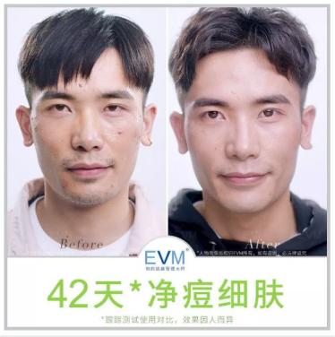 前有迪丽热巴代言，后有郭碧婷喜爱的自然之名、EVM好在哪里？