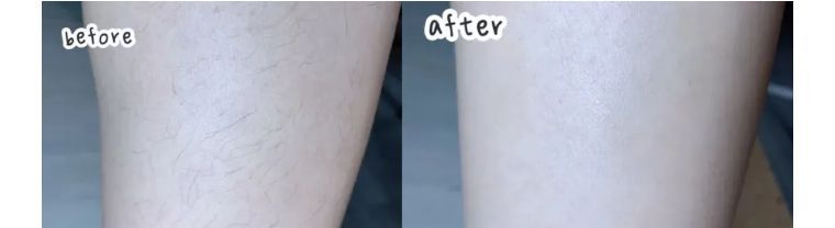 j-style脱毛仪测评,j-style美容仪好用吗