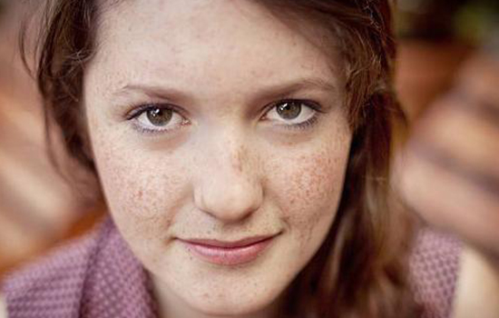 皮肤怎样淡斑,皮肤怎样补水淡斑