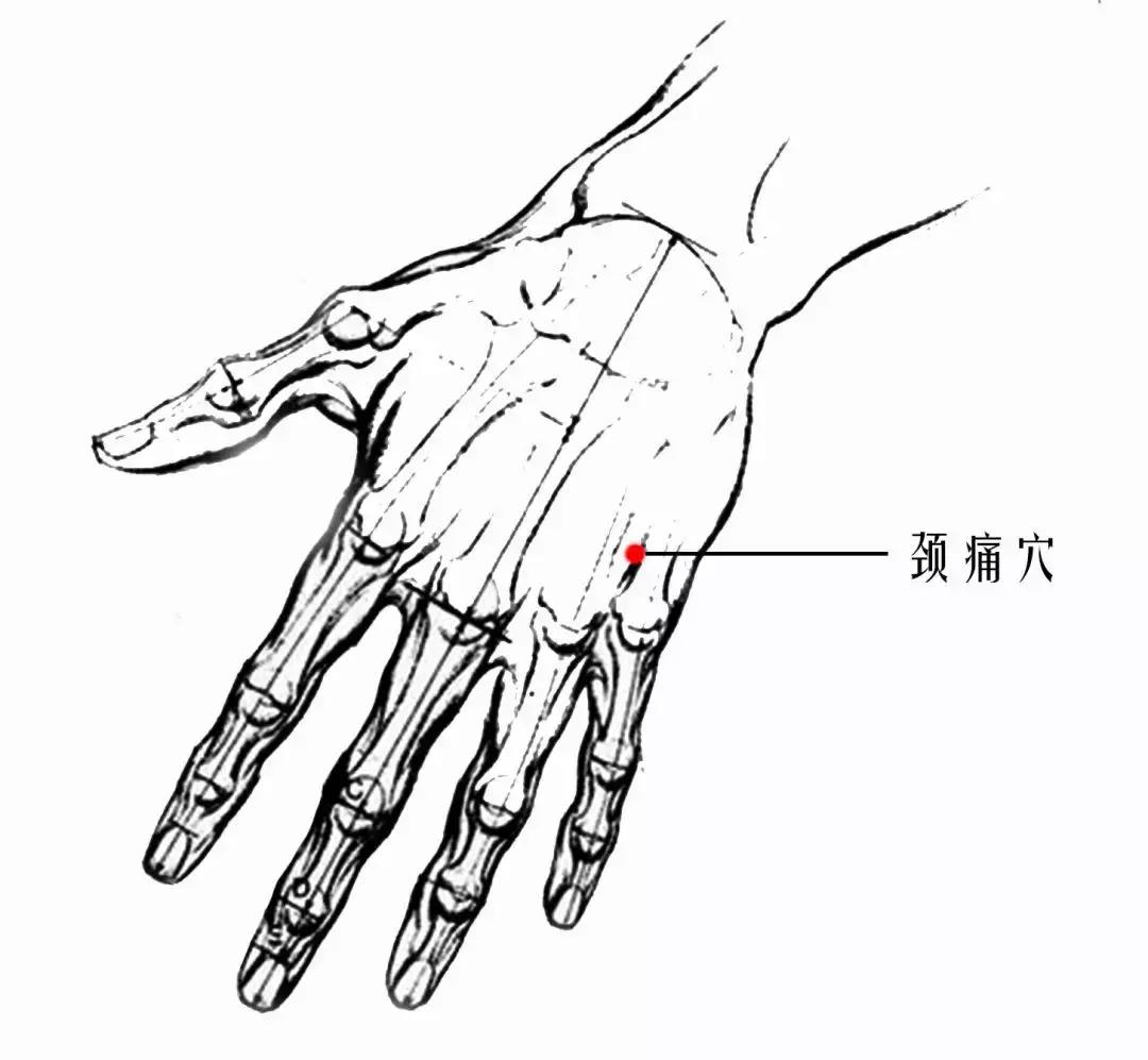 颈椎腰腿痛针刀,针刀颈椎病