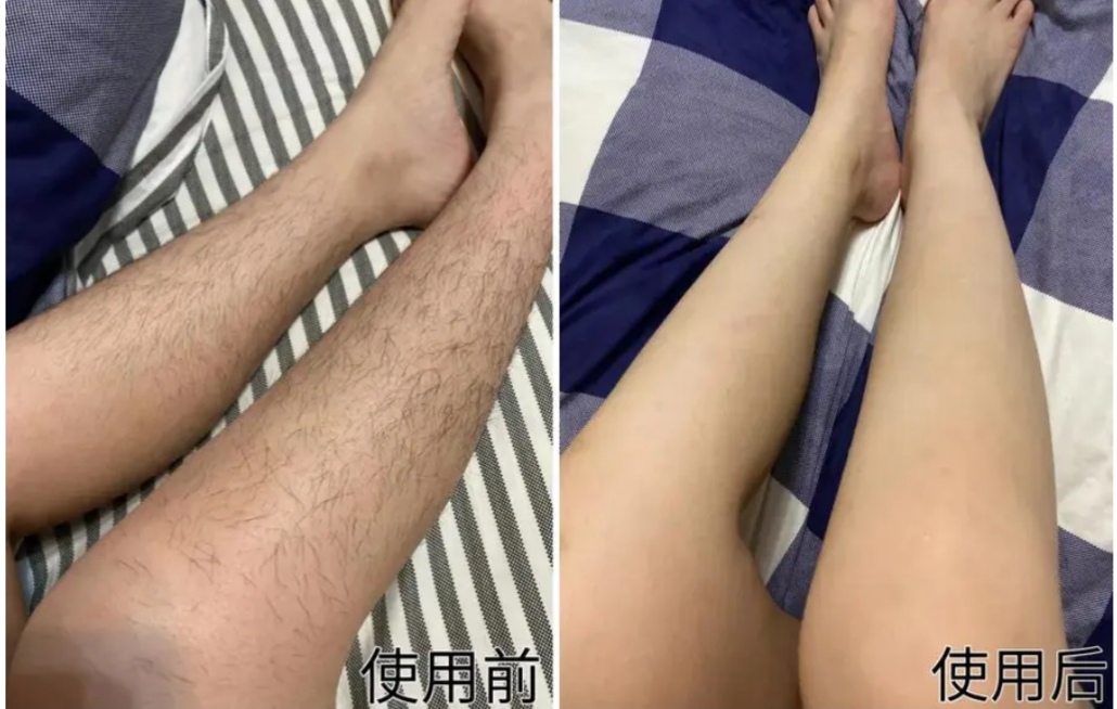黑丑的“毛裤腿”用它，10分钟“脱”得一干二净，肌肤光滑细腻。