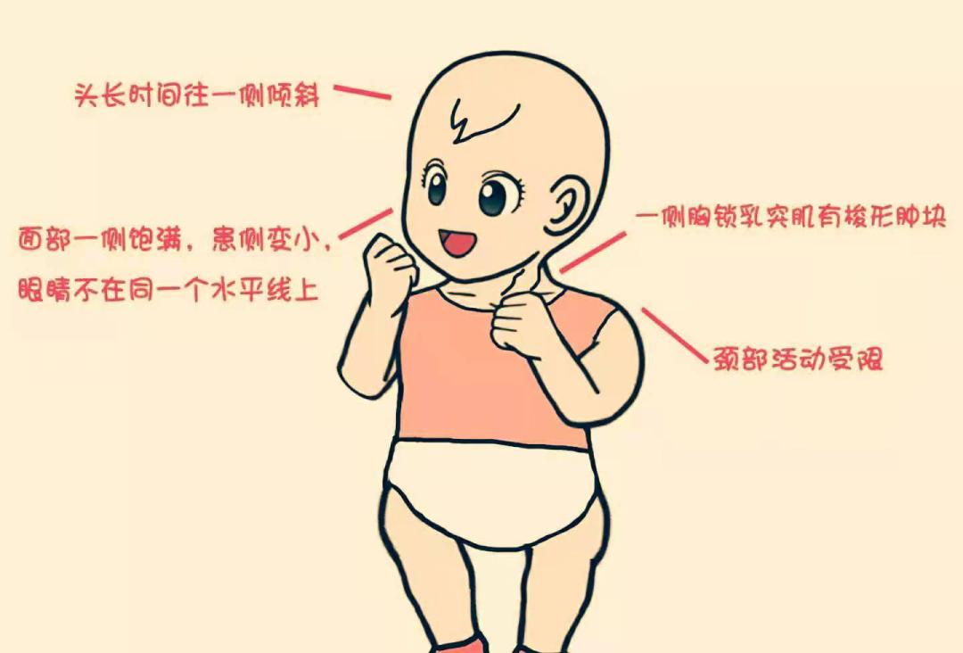 宝宝歪脖什么方法最有效,宝宝歪颈最好的解决方法