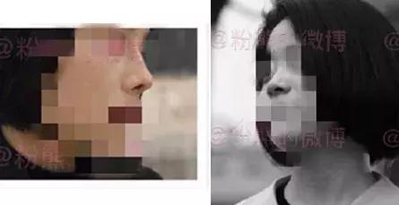 协和整形美容科专家,北京协和整形鼻综合