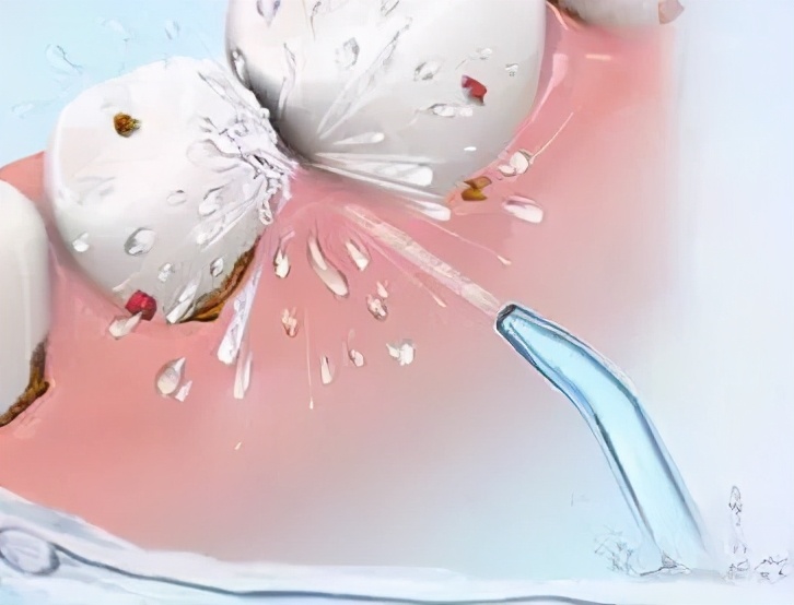 上海牙齿松动怎么修复,请问一下牙医牙齿松动是什么原因