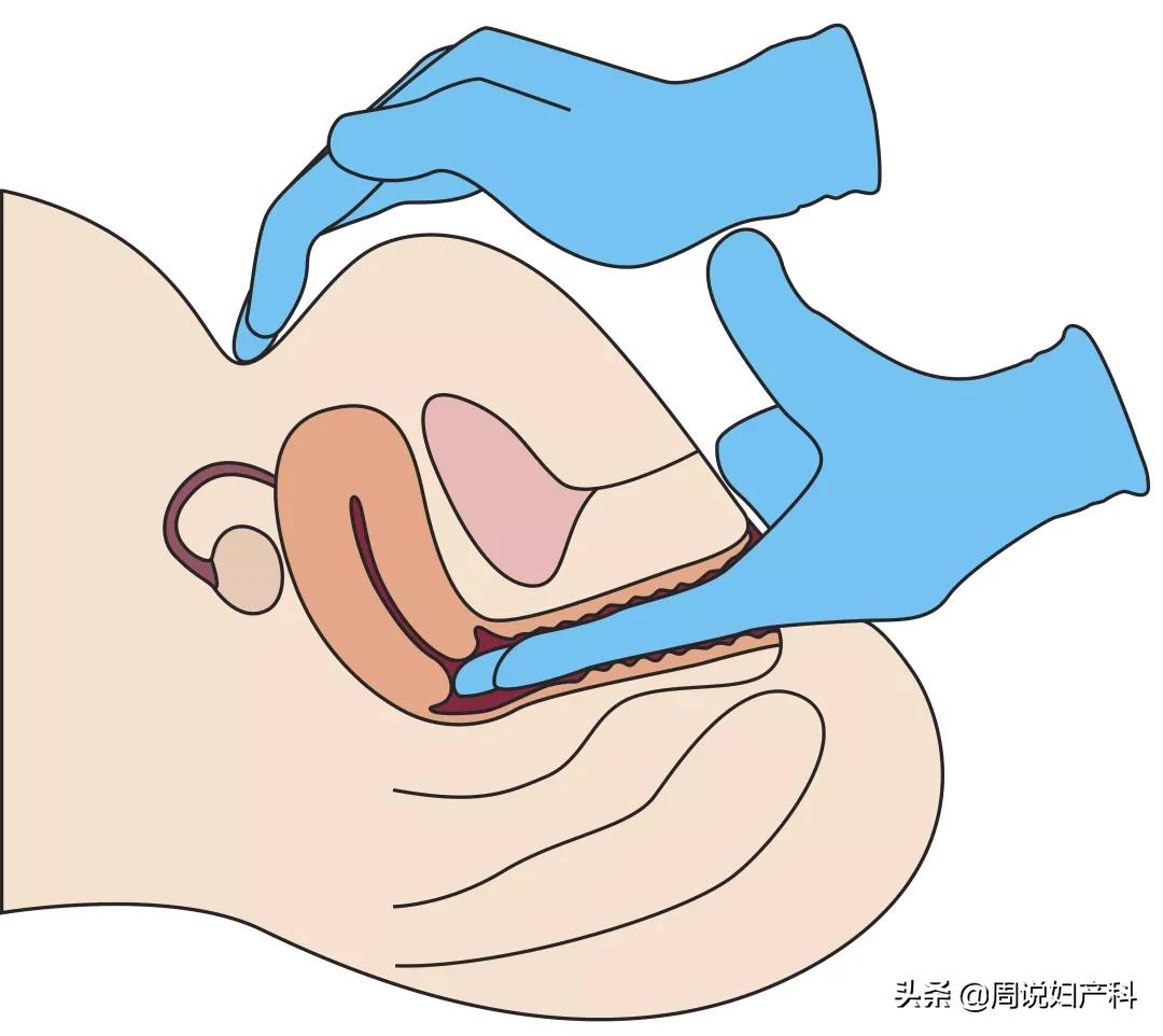 妇科医生避坑指南,妇科医生告诉你的10条建议