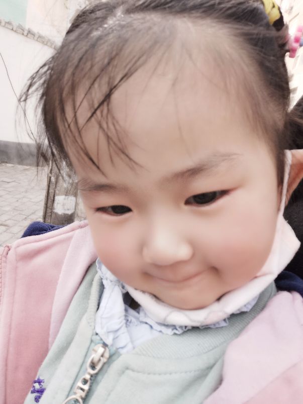 小孩过敏盐酸西替利嗪口服溶液,西替利嗪能够治愈湿疹和瘙痒吗