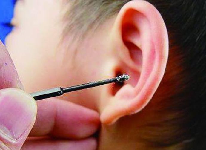 女儿耳朵进虫子,孩子耳朵里进虫子