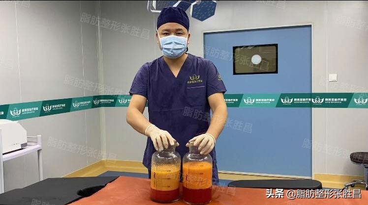 为什么吸脂会吸出血水是失败了吗,吸脂血水多有效果吗