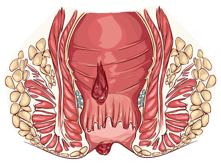 十人九痔长痔疮,十男九痔十女十痔是什么意思