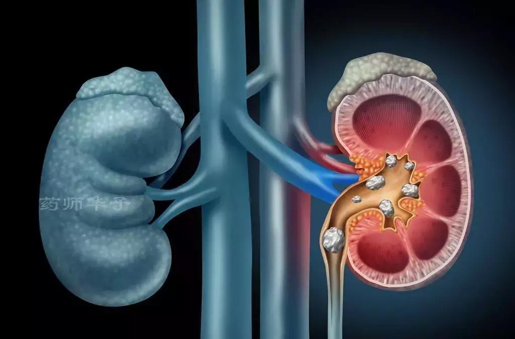 排尿有助于降尿酸缓解痛风吗,排尿对痛风有好处吗