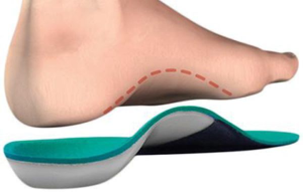 一边扁平足一边弓足如何矫正,扁平足足弓酸痛怎么治疗